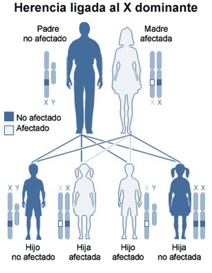 &iquest;Qu&eacute; es el S&iacute;ndrome X Fr&aacute;gil?